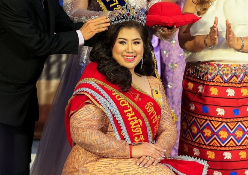 Beauty Redefined: A Pictorial Journey Through Odd Pageants